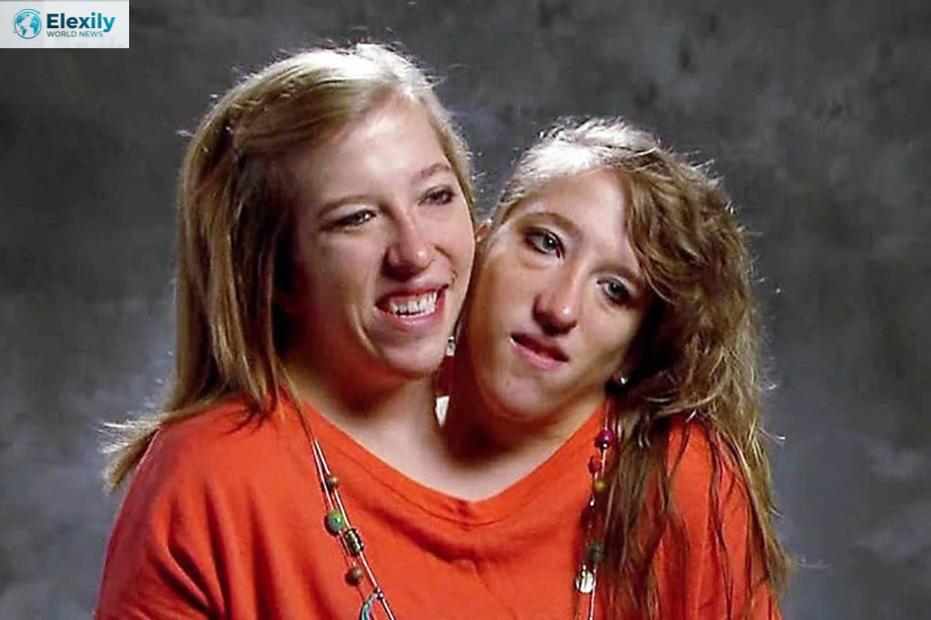 abby and brittany hensel sad news